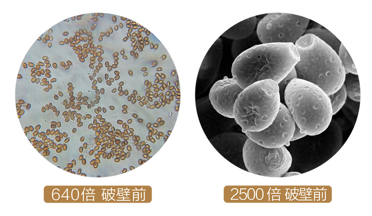 电镜下918博天娱乐官网孢子